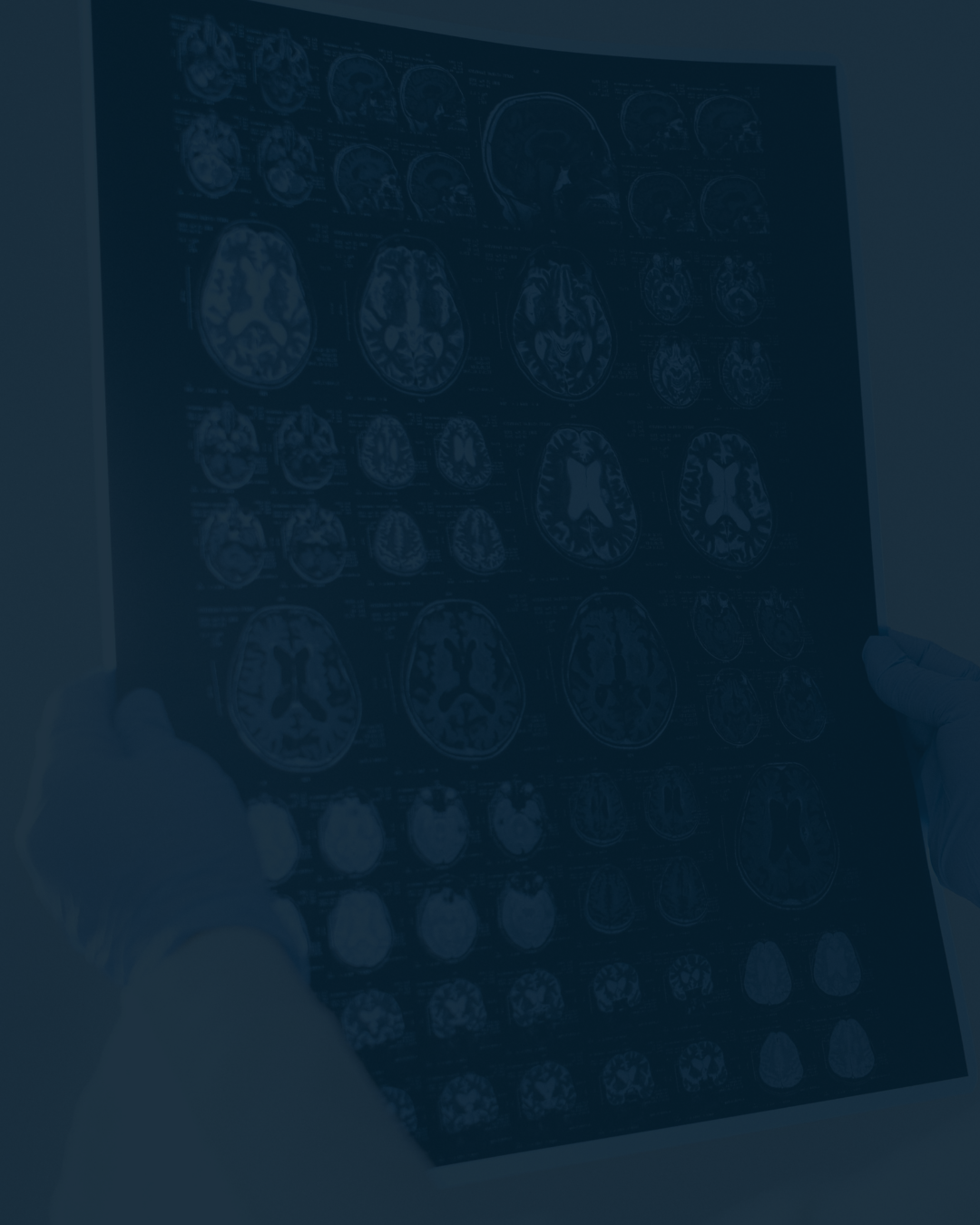 Why Brain Injury Claims Involving Children are Different