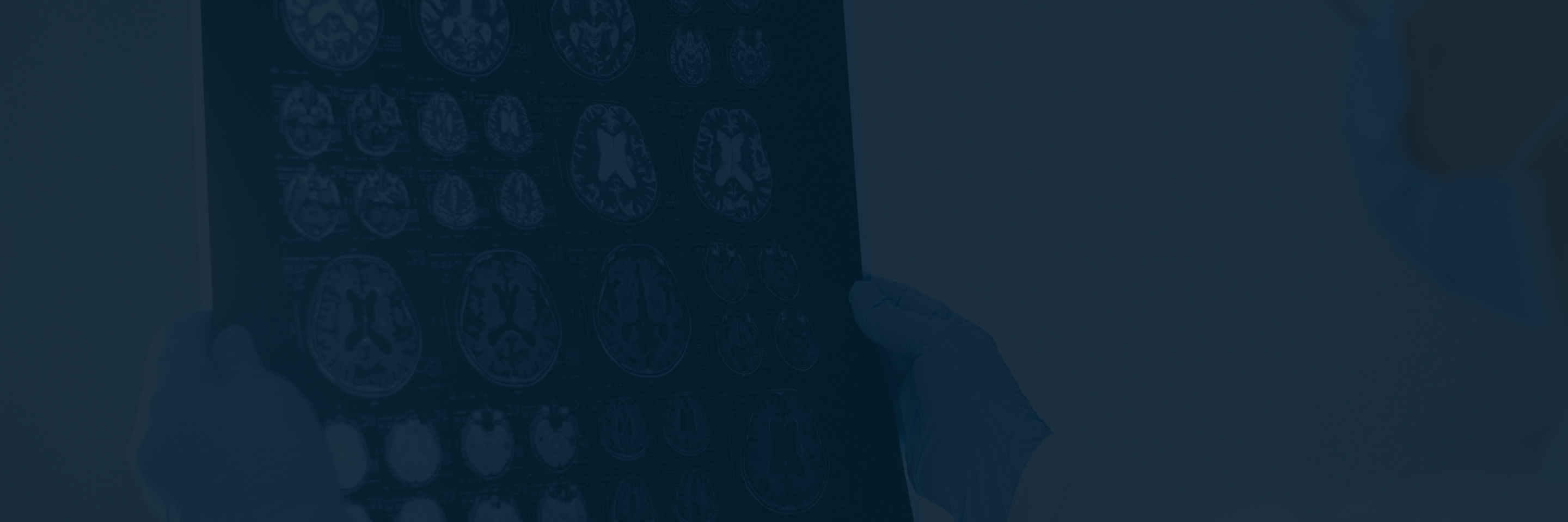 Why Brain Injury Claims Involving Children are Different